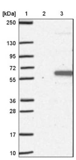 TSSC1 Antibody, Novus Biologicals 0.1mL; Unlabeled:Antibodies, Polyclonal